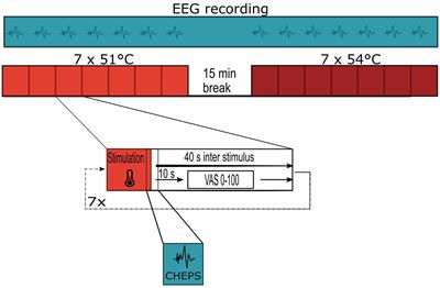 Application of Referencing Techniques in EEG-Based Recordings of Contact Heat Evoked Potentials (CHEPS)